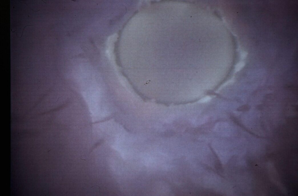 L27Equilibrio Del Microbioma Se