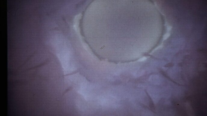 L27Equilibrio Del Microbioma Se