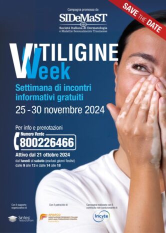 Vitiligine Week3A Iniziativa Na