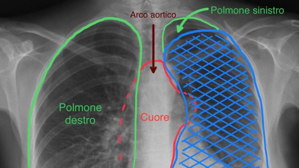 Un intervento chirurgico innov