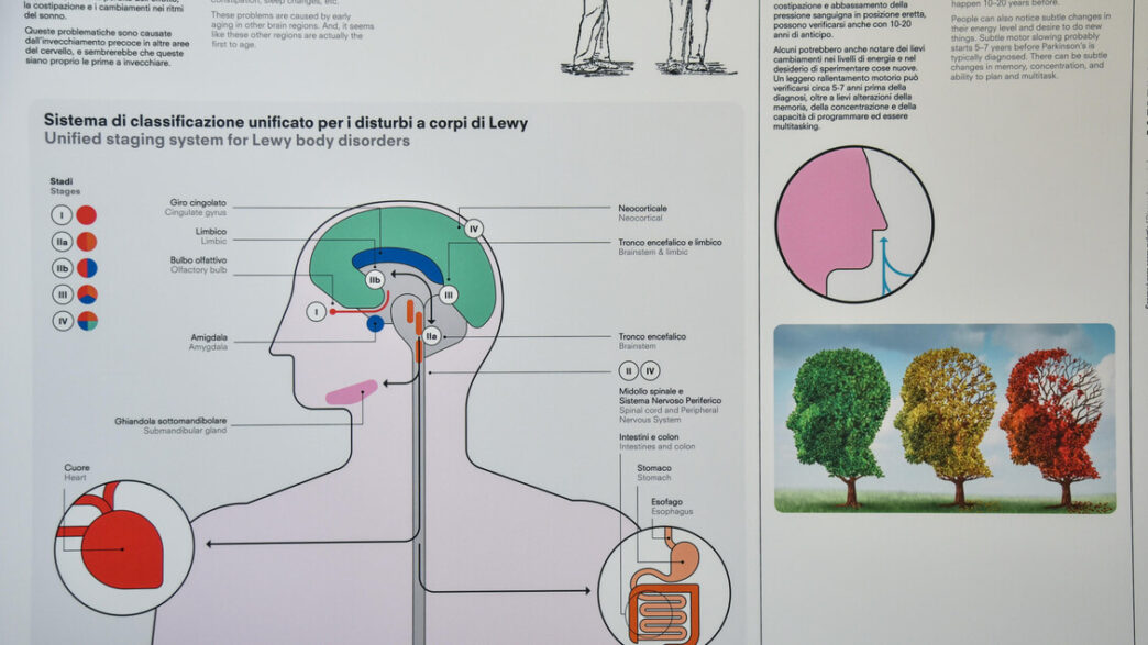 Nuove scoperte sul cervello3A c